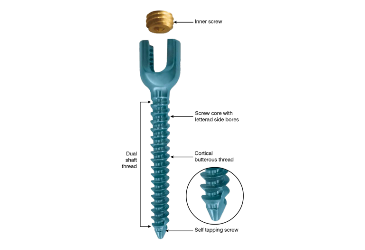 Spine Screw System – Image Ortho Surgical