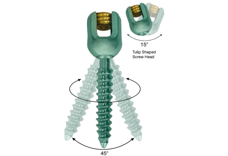 Spine Screw System – Image Ortho Surgical